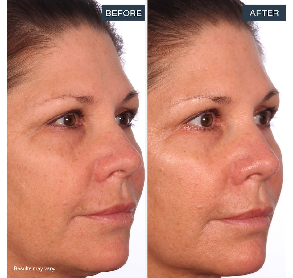 Image 113639_ALTMORE9.jpg, Product 113-639 / Price $75.00, SKINN Divine Luminous Firming Cream + Forehead Patch from SKINN on TSC.ca's Beauty department