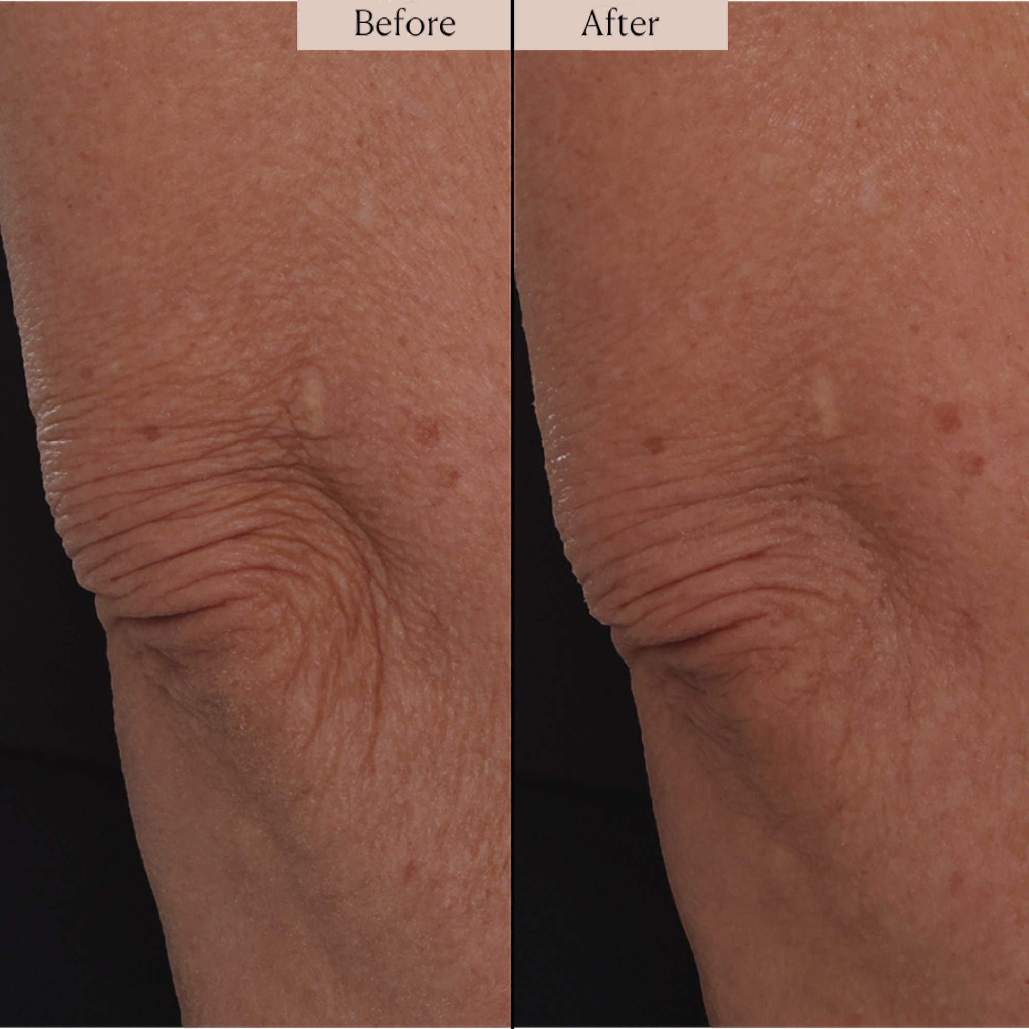 Nakery SkinRecovery Energize + Repair Body Cream With NAD+