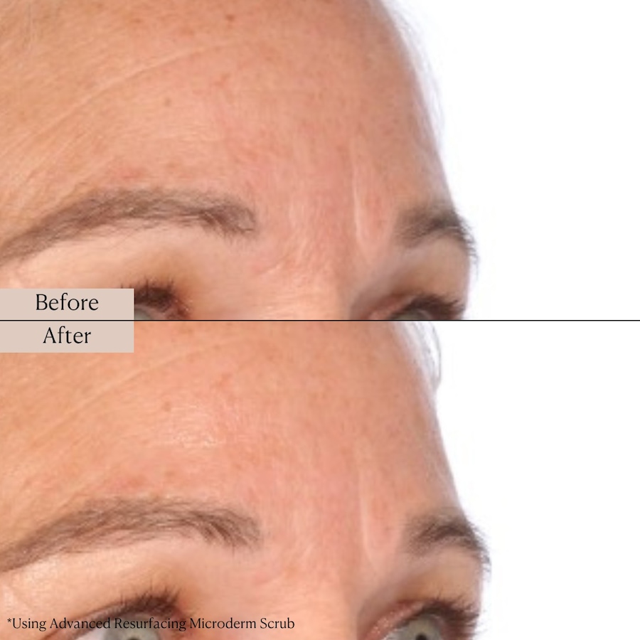 Image 114332_ALTMORE10.jpg, Product 114-332 / Price $39.99, Nakery Supersize LiftTox + Advanced Resurfacing Microderm Treatment from Nakery Beauty on TSC.ca's Beauty department