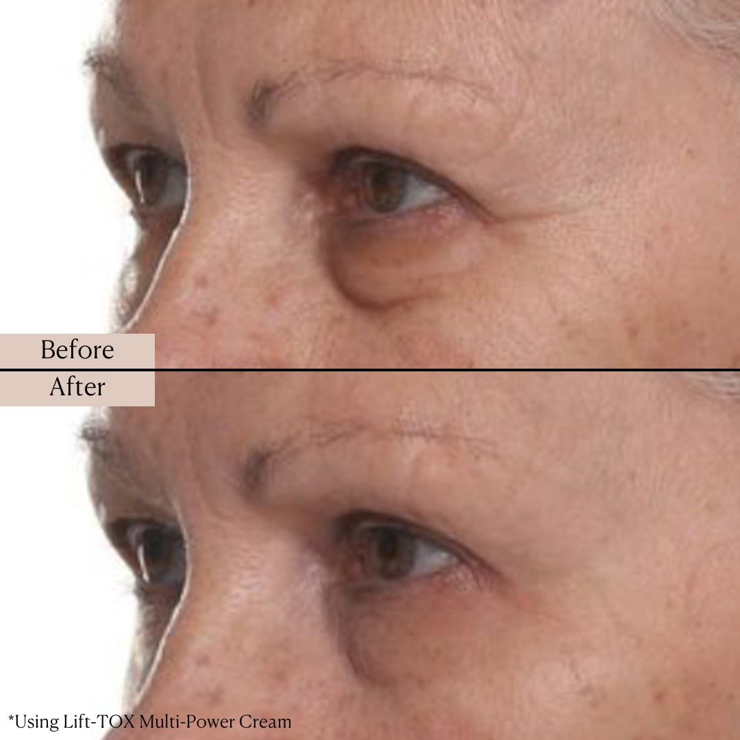 Nakery Supersize LiftTox + Advanced Resurfacing Microderm