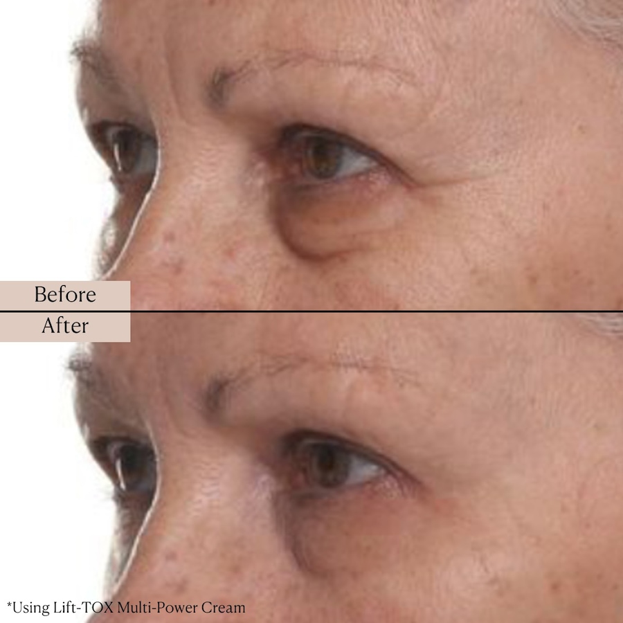 Image 114332_ALTMORE4.jpg, Product 114-332 / Price $39.99, Nakery Supersize LiftTox + Advanced Resurfacing Microderm Treatment from Nakery Beauty on TSC.ca's Beauty department