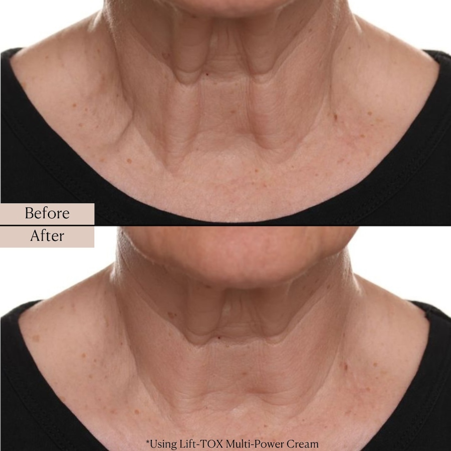 Image 114332_ALTMORE5.jpg, Product 114-332 / Price $39.99, Nakery Supersize LiftTox + Advanced Resurfacing Microderm Treatment from Nakery Beauty on TSC.ca's Beauty department
