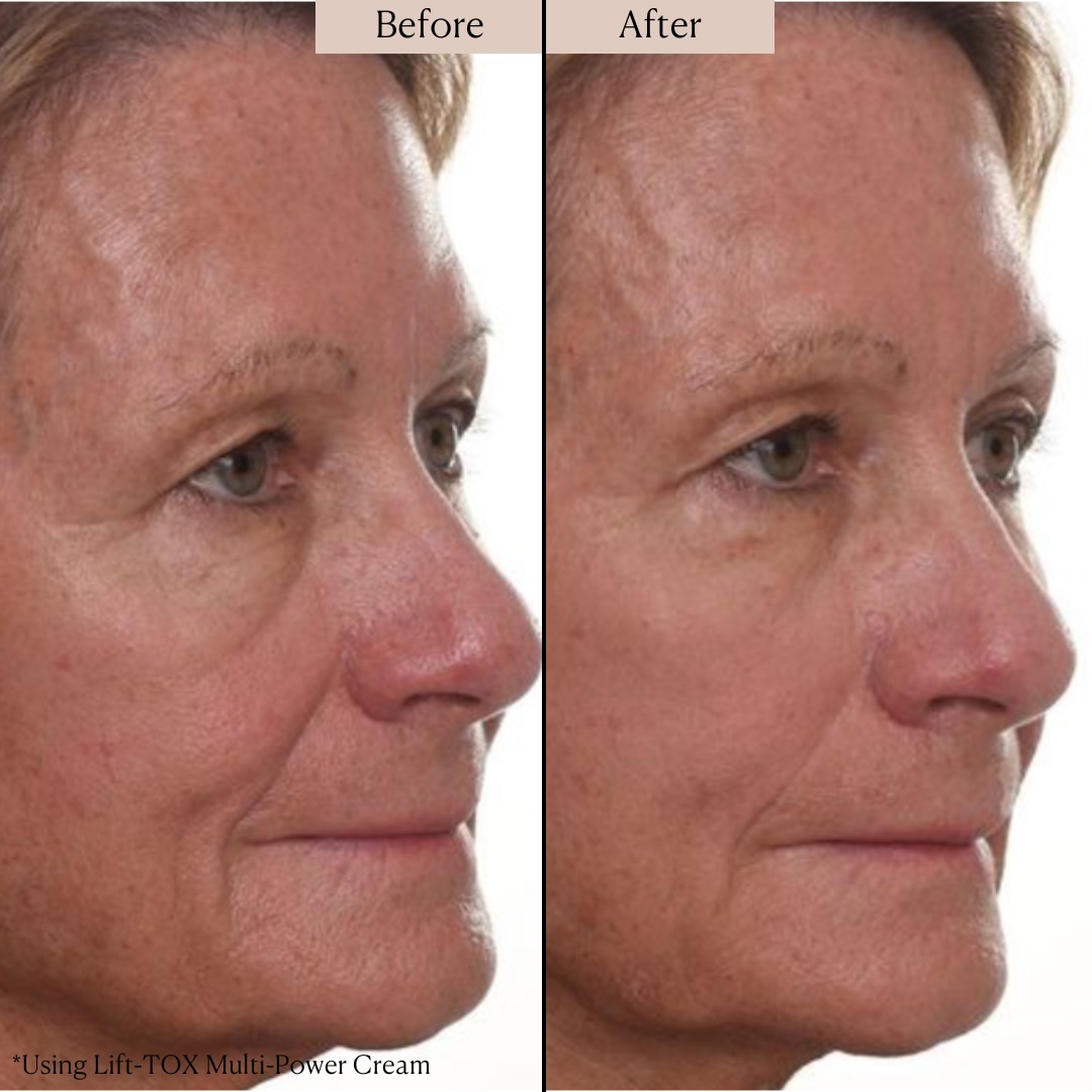 Nakery Supersize LiftTox + Advanced Resurfacing Microderm