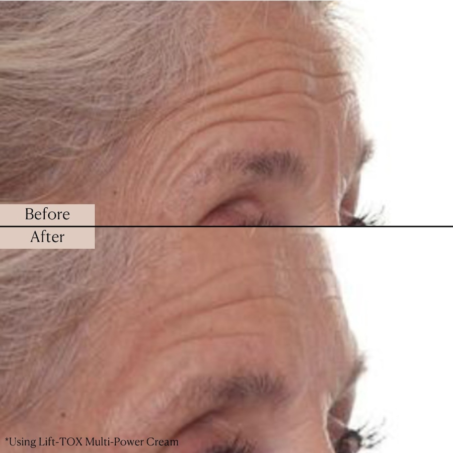 Image 114332_ALTMORE7.jpg, Product 114-332 / Price $39.99, Nakery Supersize LiftTox + Advanced Resurfacing Microderm Treatment from Nakery Beauty on TSC.ca's Beauty department