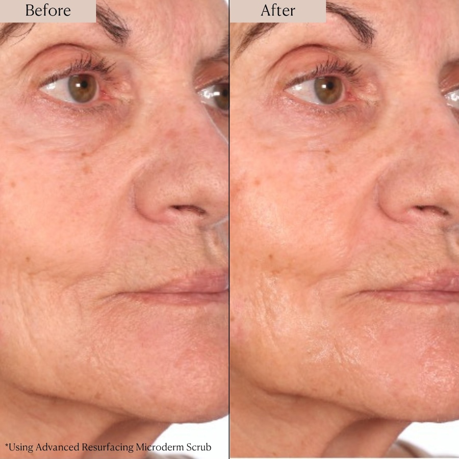 Image 114332_ALTMORE8.jpg, Product 114-332 / Price $39.99, Nakery Supersize LiftTox + Advanced Resurfacing Microderm Treatment from Nakery Beauty on TSC.ca's Beauty department