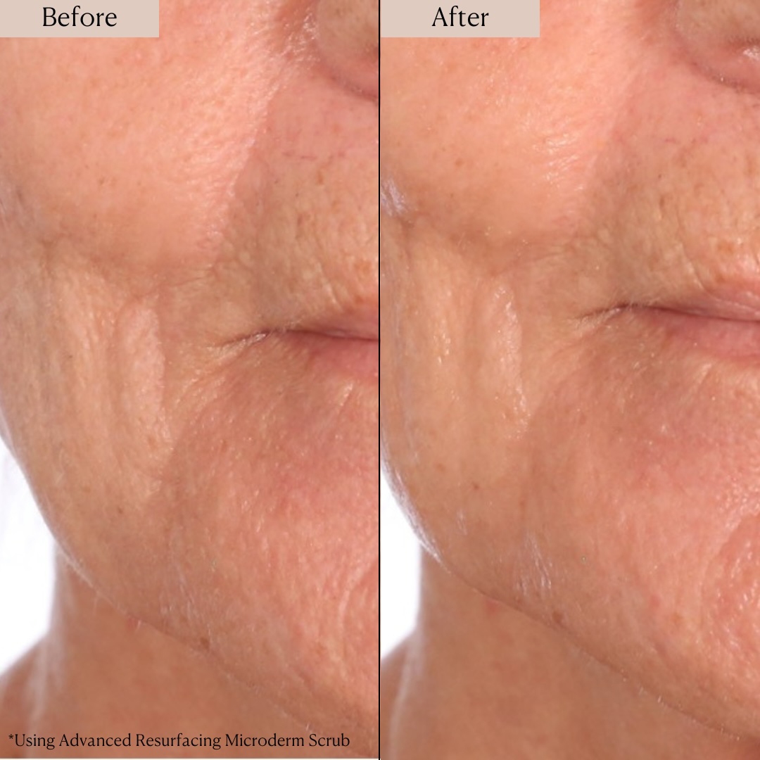 フェイスクリーム Tskts Nakery Supersize LiftTox + Advanced Resurfacing Microderm