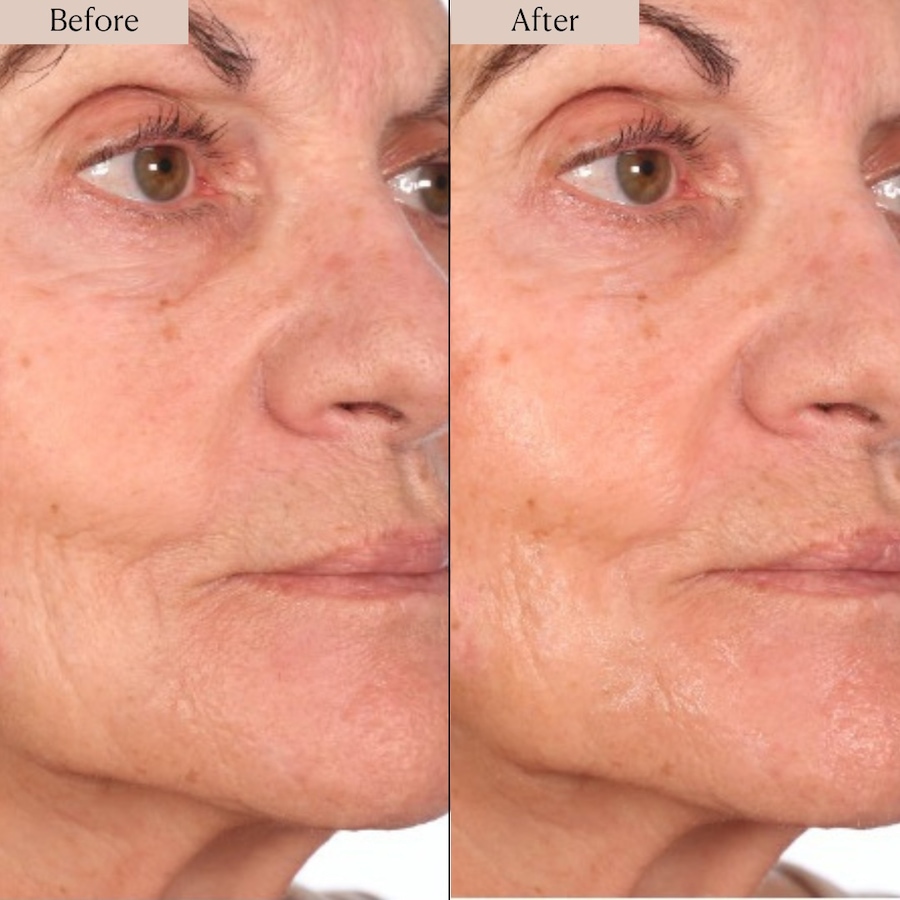 Image 114440_ALTMORE5.jpg, Product 114-440 / Price $60.00, Nakery Advanced Resurfacing Microderm Treatment from Nakery Beauty on TSC.ca's Beauty department