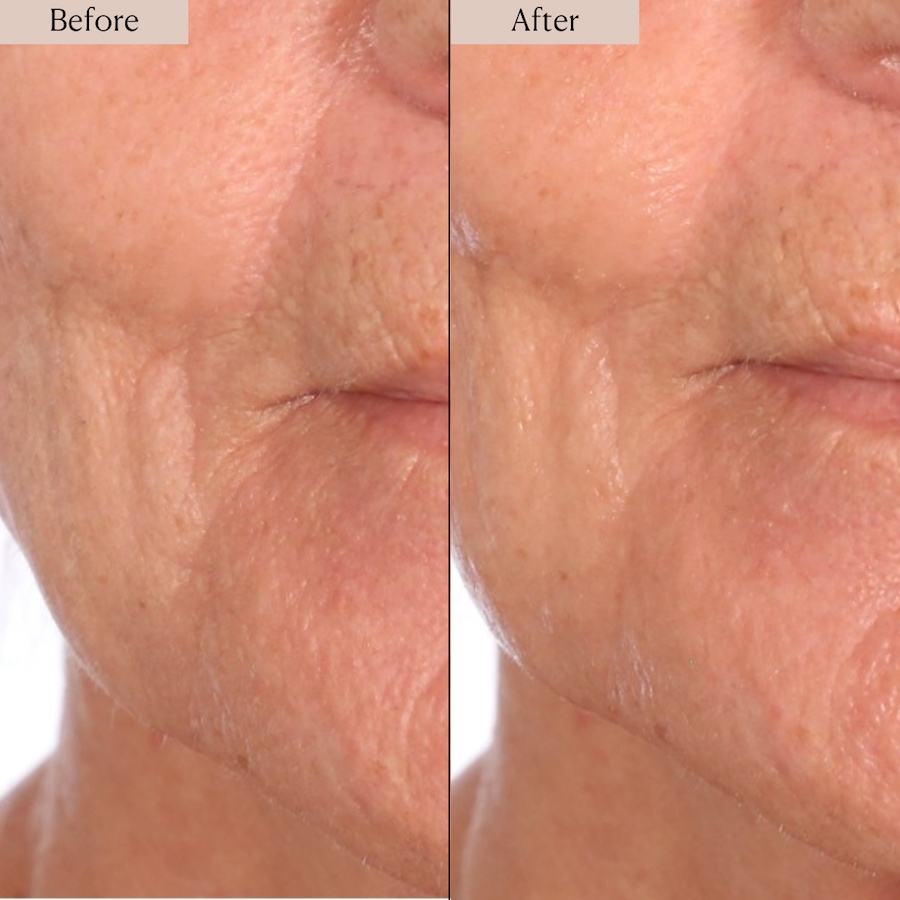 Image 114440_ALTMORE6.jpg, Product 114-440 / Price $60.00, Nakery Advanced Resurfacing Microderm Treatment from Nakery Beauty on TSC.ca's Beauty department