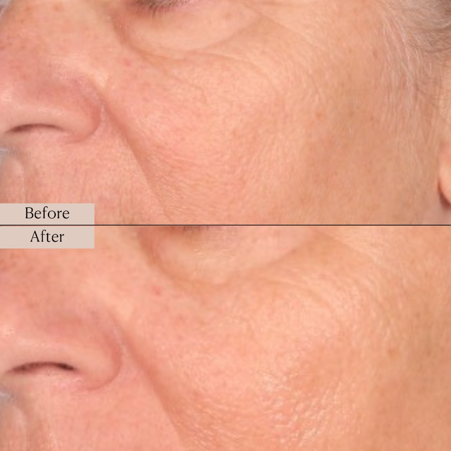 Image 114440_ALTMORE8.jpg, Product 114-440 / Price $60.00, Nakery Advanced Resurfacing Microderm Treatment from Nakery Beauty on TSC.ca's Beauty department
