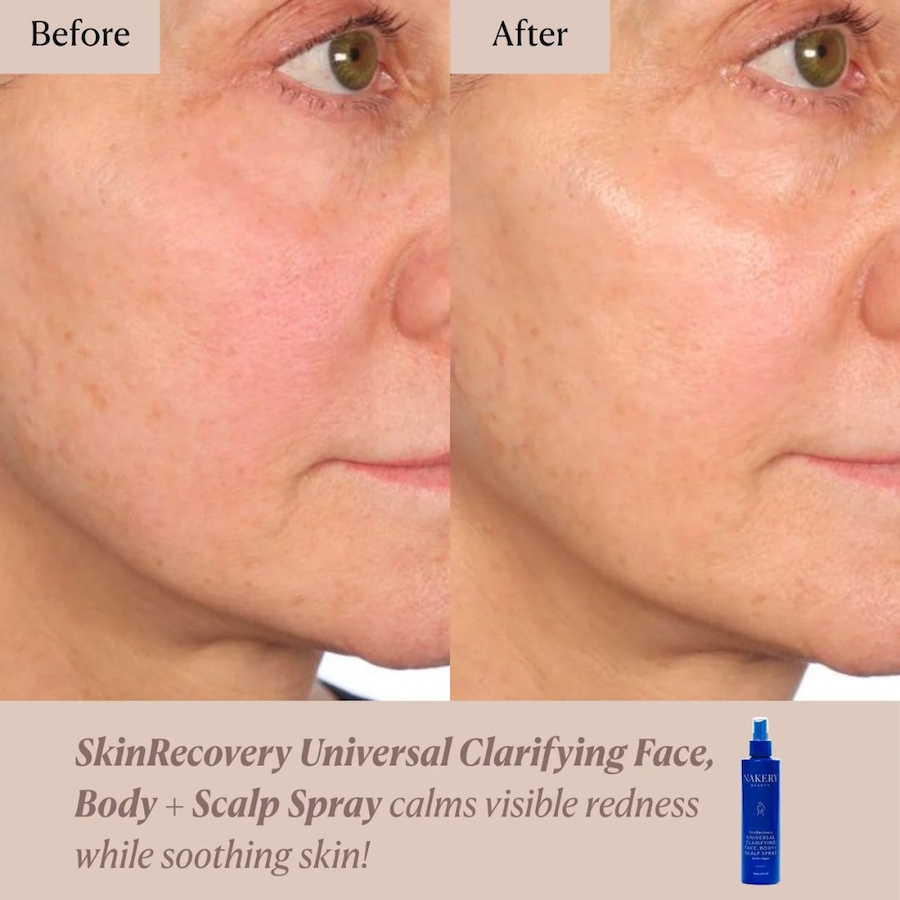 Image 114818_ALTMORE3.jpg, Product 114-818 / Price $45.00, Nakery SkinRecovery Universal Clarifying Face, Body, and Scalp Spray from Nakery Beauty on TSC.ca's Beauty department