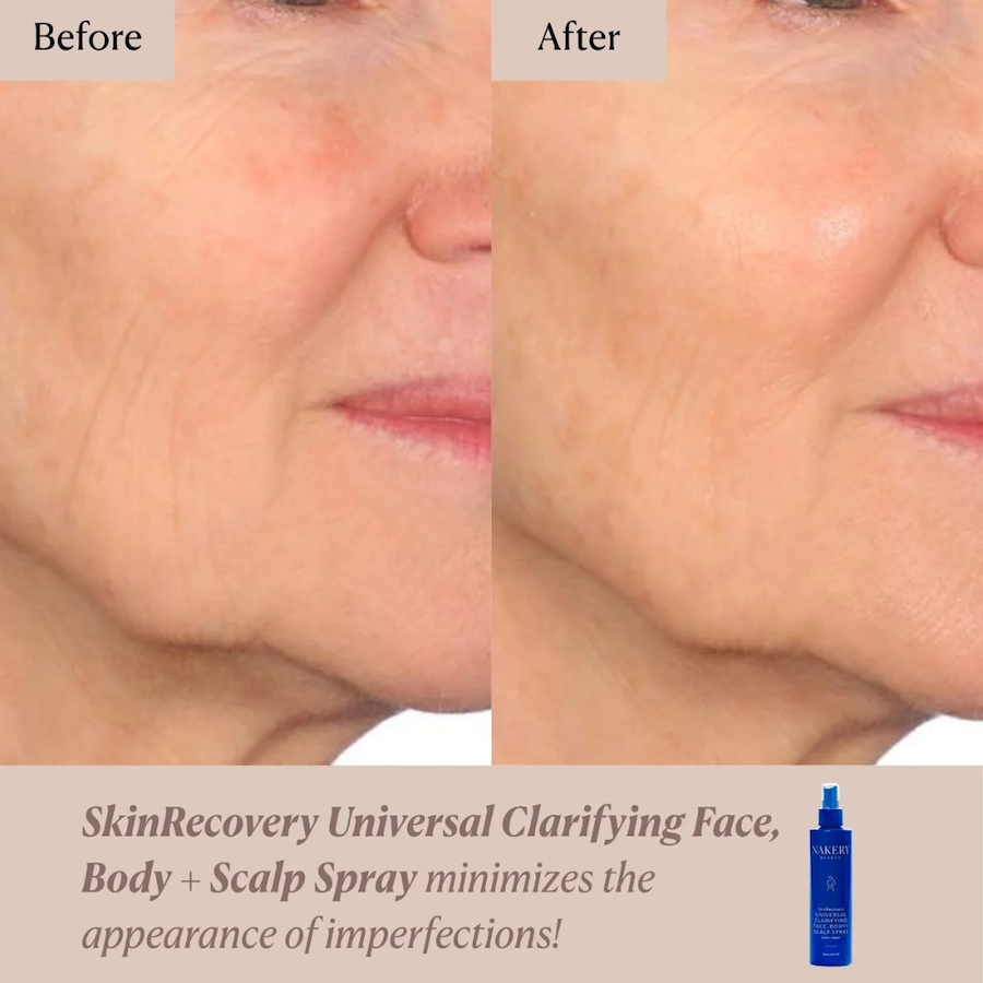 Image 114818_ALTMORE4.jpg, Product 114-818 / Price $45.00, Nakery SkinRecovery Universal Clarifying Face, Body, and Scalp Spray from Nakery Beauty on TSC.ca's Beauty department
