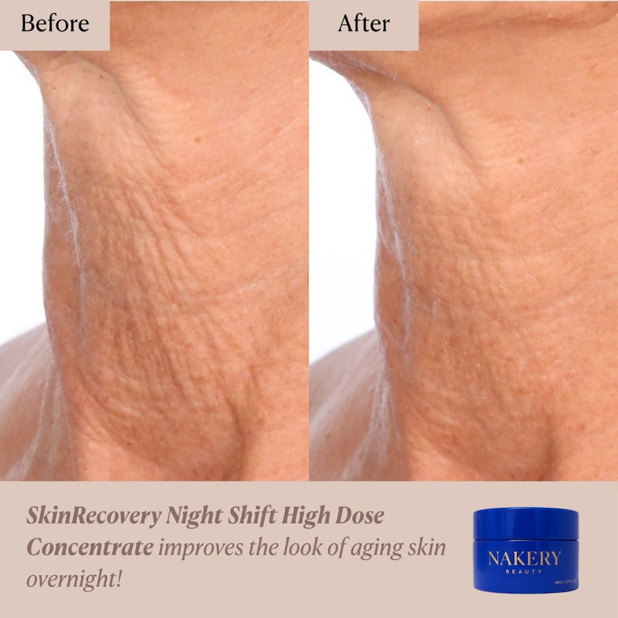 Image 127199_ALTMORE5.jpg, Product 127-199 / Price $64.00, Nakery SkinRecovery Night Shift High Dose Concentrate Gravity Reset from Nakery Beauty on TSC.ca's Beauty department