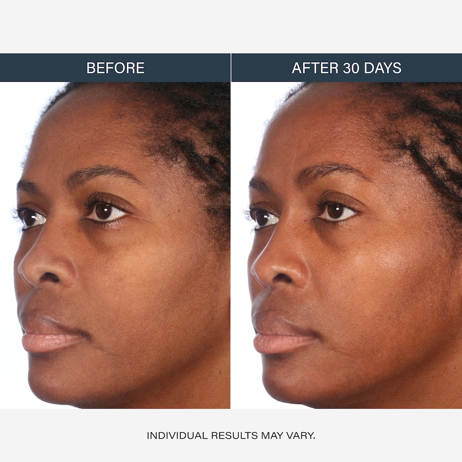 Image 127266_ALTMORE1.jpg, Product 127-266 / Price $46.00, SKINN Non‑Negotiables DermAppeal Daily Gentle Cream Exfoliator With Balancing Post‑Biotics from SKINN on TSC.ca's Beauty department
