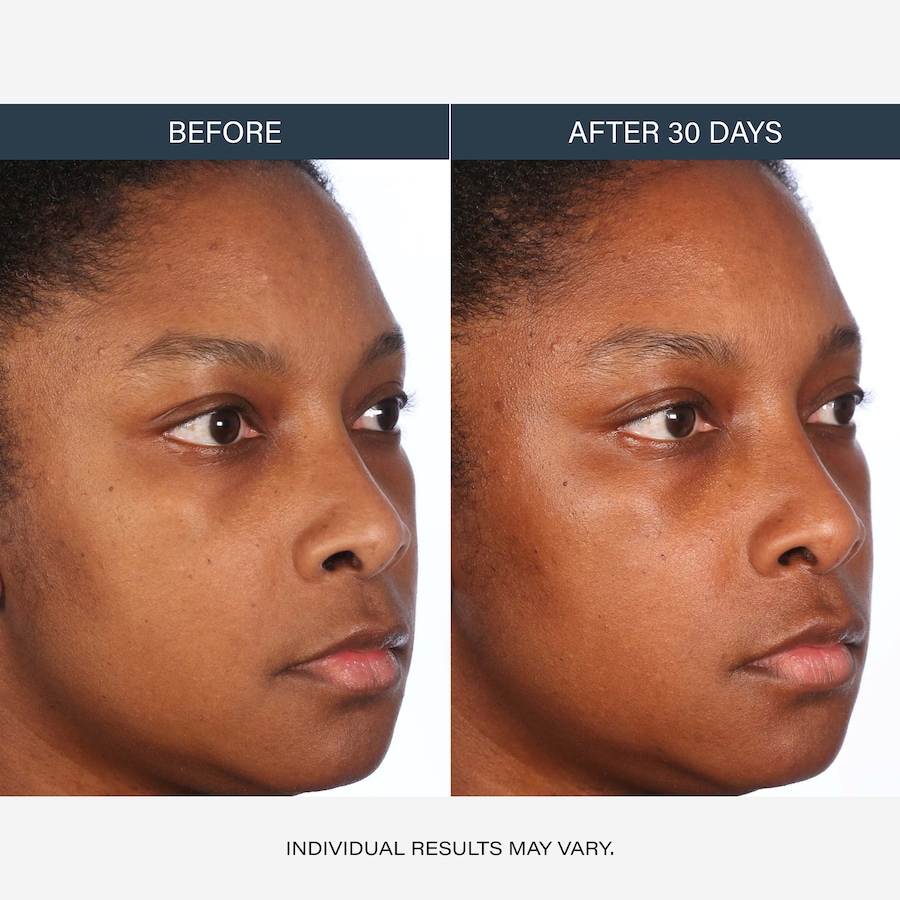 Image 127266_ALTMORE3.jpg, Product 127-266 / Price $46.00, SKINN Non‑Negotiables DermAppeal Daily Gentle Cream Exfoliator With Balancing Post‑Biotics from SKINN on TSC.ca's Beauty department