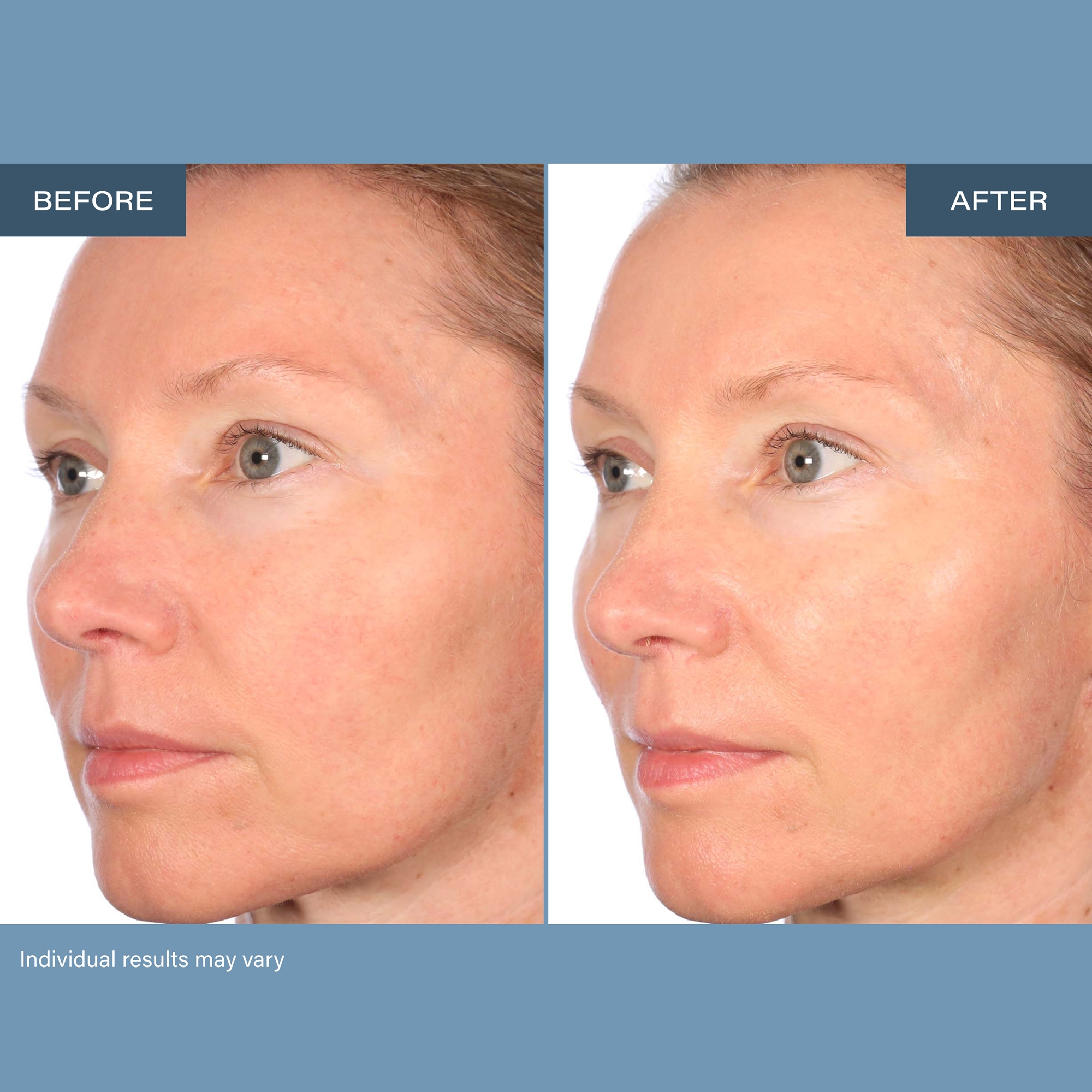 SKINN Age Reset Day & Night Cream Bundle - TSC.ca