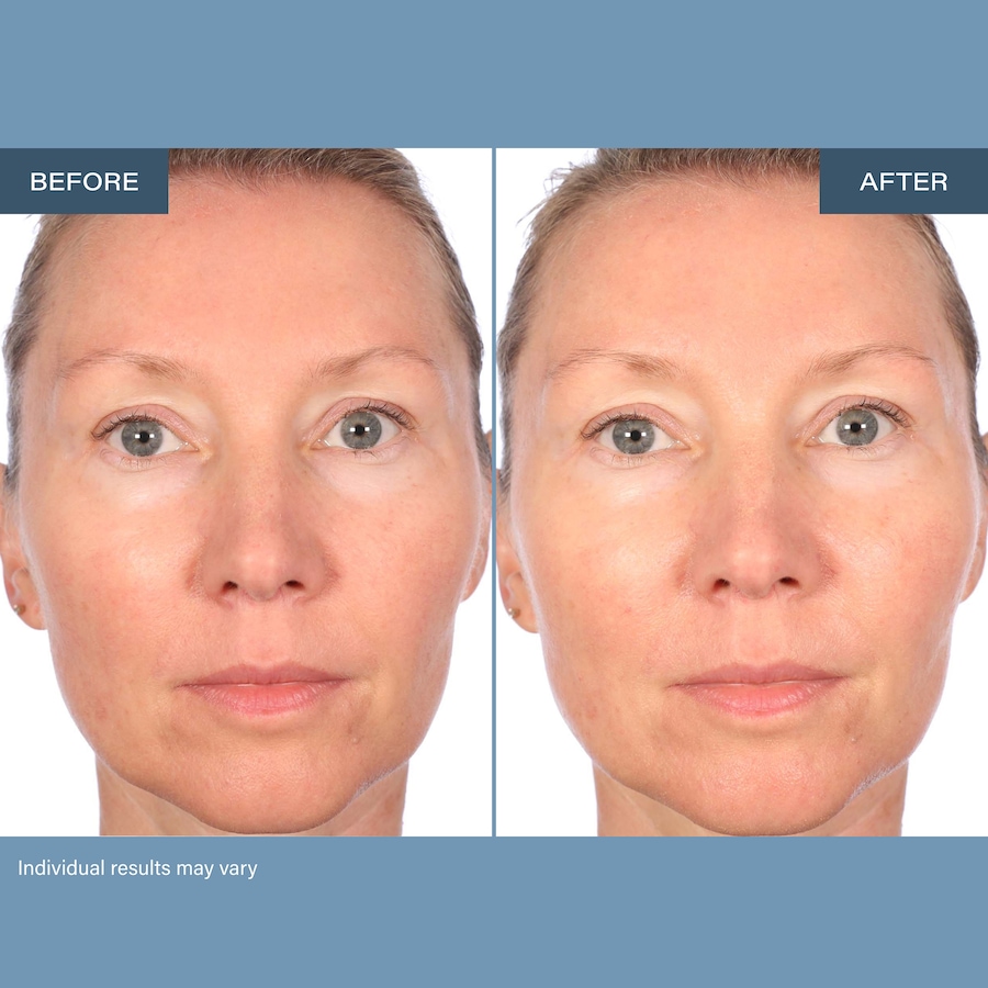 Image 127268_ALTMORE6.jpg, Product 127-268 / Price $175.99, SKINN Age Reset Day & Night Cream Bundle  from SKINN on TSC.ca's Beauty department