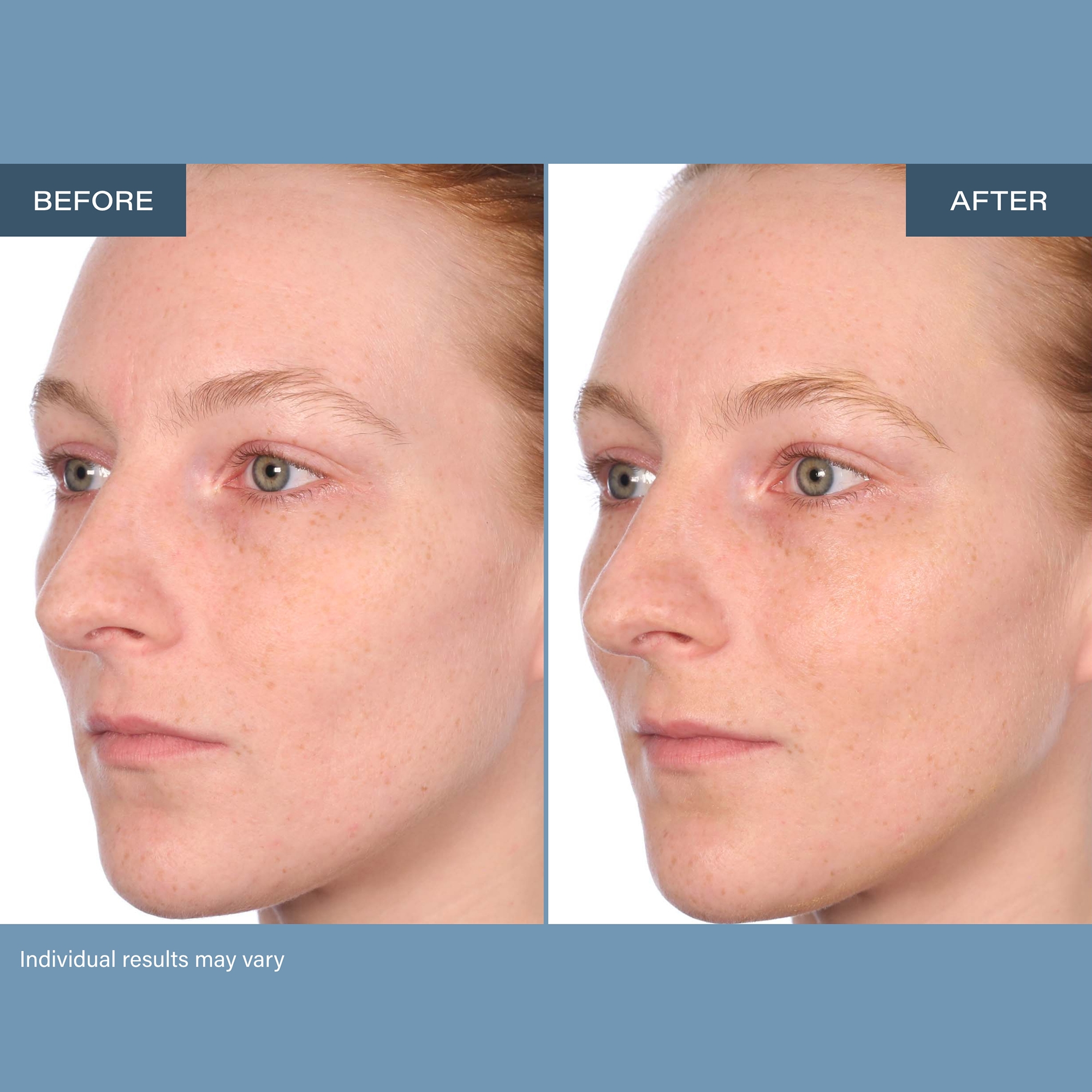 SKINN Age Reset Day & Night Cream Bundle - TSC.ca