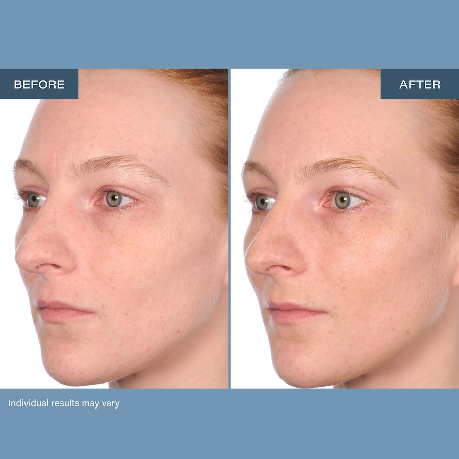 Image 127268_ALTMORE7.jpg, Product 127-268 / Price $175.99, SKINN Age Reset Day & Night Cream Bundle  from SKINN on TSC.ca's Beauty department