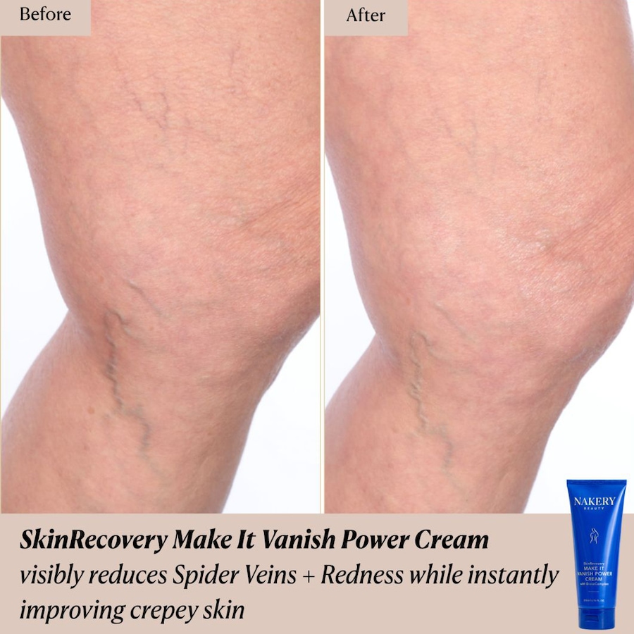 Image 127549_ALTMORE3.jpg, Product 127-549 / Price $39.50, Nakery Skinrecovery Make It Vanish Power Cream Duo from Nakery Beauty on TSC.ca's Beauty department