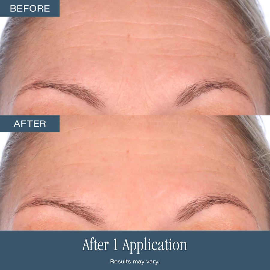 Image 127590_ALTMORE10.jpg, Product 127-590 / Price $129.99, SKINN Non-Negotiables DermAppeal from SKINN on TSC.ca's Beauty department