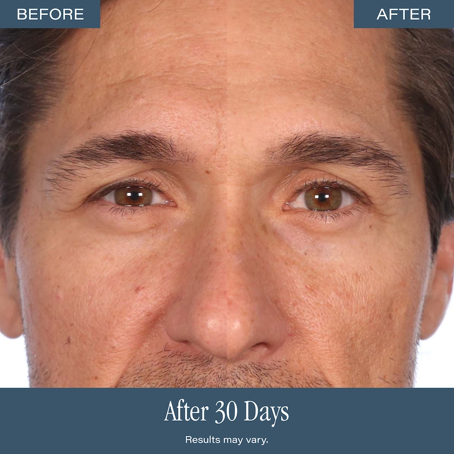 Image 127590_ALTMORE11.jpg, Product 127-590 / Price $129.99, SKINN Non-Negotiables DermAppeal from SKINN on TSC.ca's Beauty department