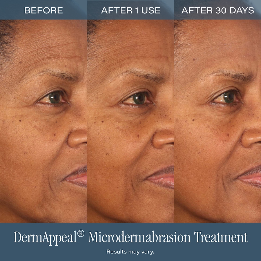 Image 127590_ALTMORE9.jpg, Product 127-590 / Price $129.99, SKINN Non-Negotiables DermAppeal from SKINN on TSC.ca's Beauty department