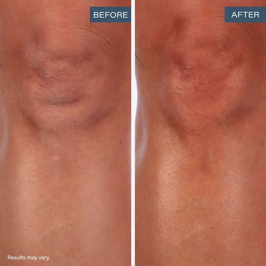 Image 205250_ALTMORE4.jpg, Product 205-250 / Price $59.99, SKINN Divine Elixir Revitalizing Ayurvedic Body Blend from SKINN on TSC.ca's Beauty department