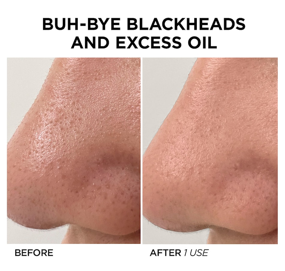 Image 231228_ALTMORE9.jpg, Product 231-228 / Price $249.00, BeautyBio GLOfacial Hydration Facial Pore Cleansing Tool from BEAUTYBIO on TSC.ca's Beauty department