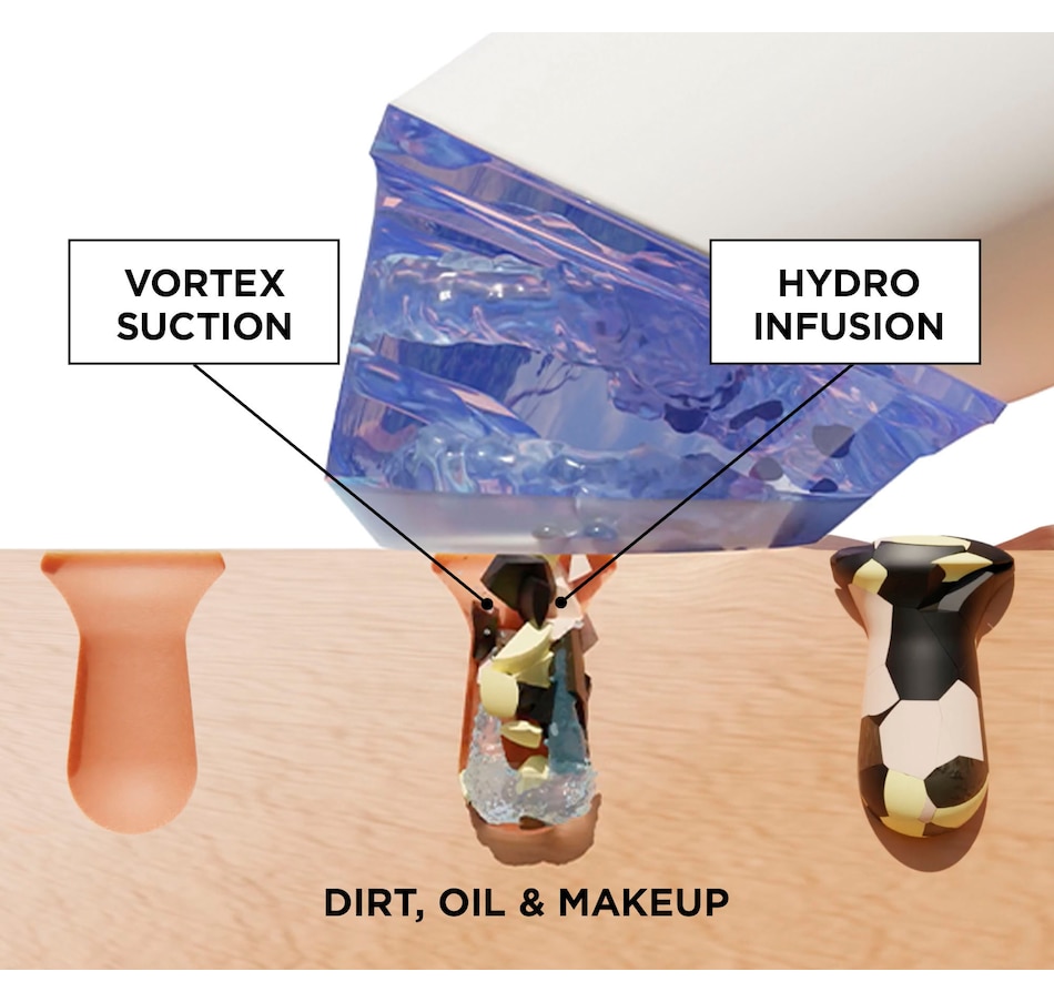 Image 235142_ALTMORE6.jpg, Product 235-142 / Price $134.88, GLOfacial Pore Cleansing Tool with Collagen Concentrate from BEAUTYBIO on TSC.ca's Beauty department