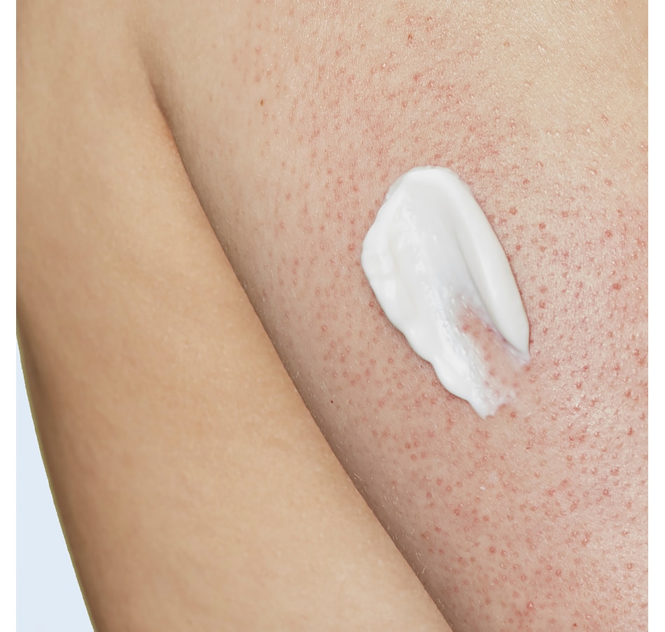 Image 244546_ALTMORE2.jpg, Product 244-546 / Price $68.00, Skinfix KP + Psoriasis Smoothing Body Treatment Body Cream from Skinfix on TSC.ca's Beauty department