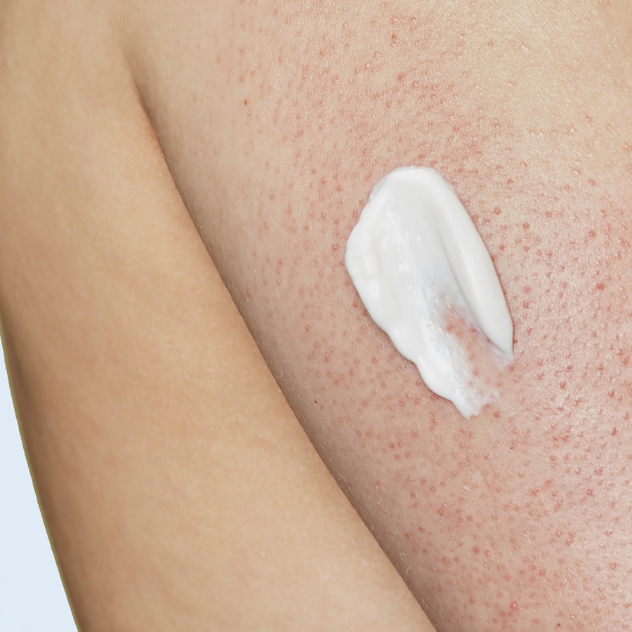 Image 244546_ALTMORE2.jpg, Product 244-546 / Price $22.00, Skinfix KP + Psoriasis Smoothing Body Treatment Body Cream from Skinfix on TSC.ca's Beauty department