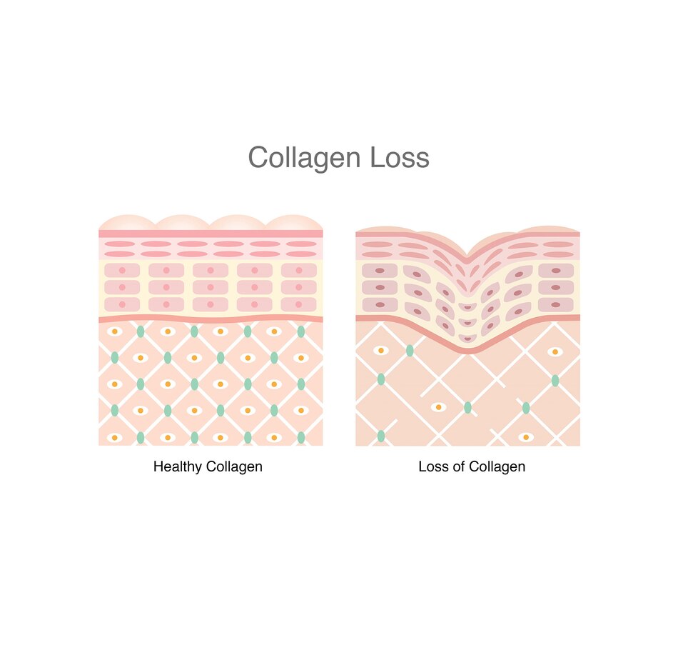 Image 245800_ALTMORE4.jpg, Product 245-800 / Price $99.99, 60-Day Auto-Delivery VitaTree Care Collagen Powder Unflavoured 2 Pouches from VitaTree Nutritionals on TSC.ca's Health & Fitness department