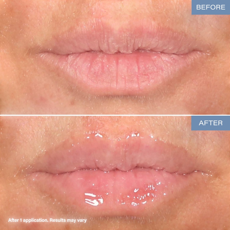 Image 251968_ALTMORE4.jpg, Product 251-968 / Price $39.99, SKINN Lip6x from SKINN on TSC.ca's Beauty department