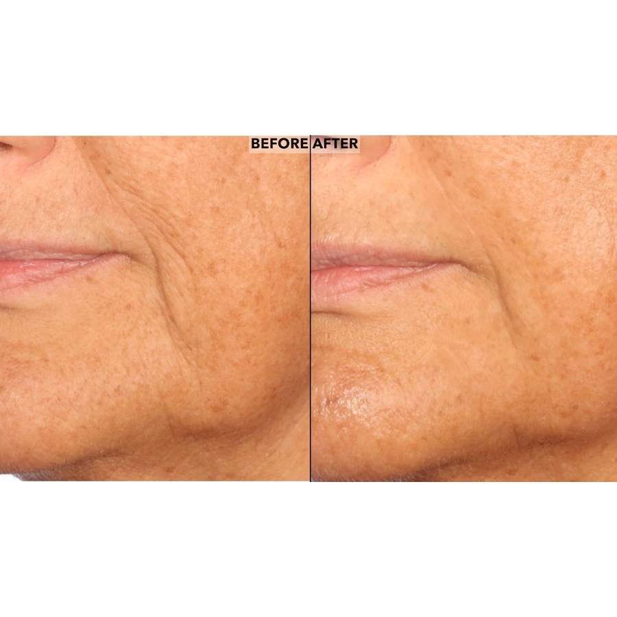 Image 252473_ALTMORE2.jpg, Product 252-473 / Price $60.00, Nakery Peptide Surge Intensive Collagen Concentrate from Nakery Beauty on TSC.ca's Beauty department