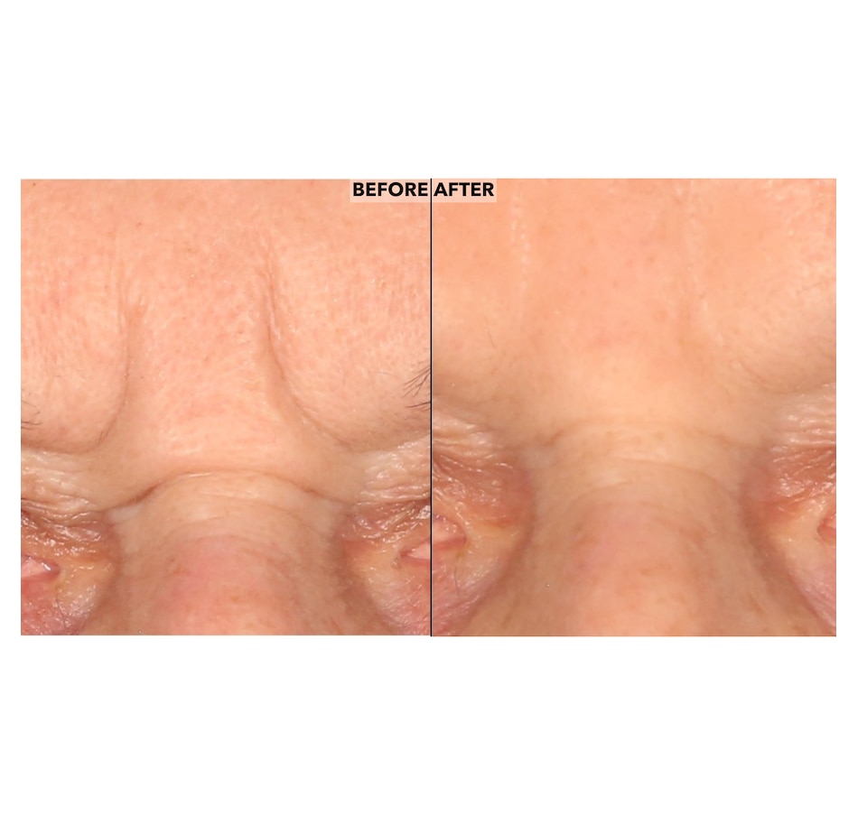 Image 252473_ALTMORE3.jpg, Product 252-473 / Price $49.50, Nakery Peptide Surge Intensive Collagen Concentrate from Nakery Beauty on TSC.ca's Beauty department