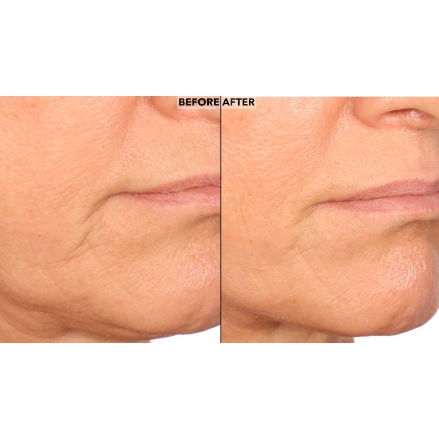 Image 252473_ALTMORE4.jpg, Product 252-473 / Price $60.00, Nakery Peptide Surge Intensive Collagen Concentrate from Nakery Beauty on TSC.ca's Beauty department