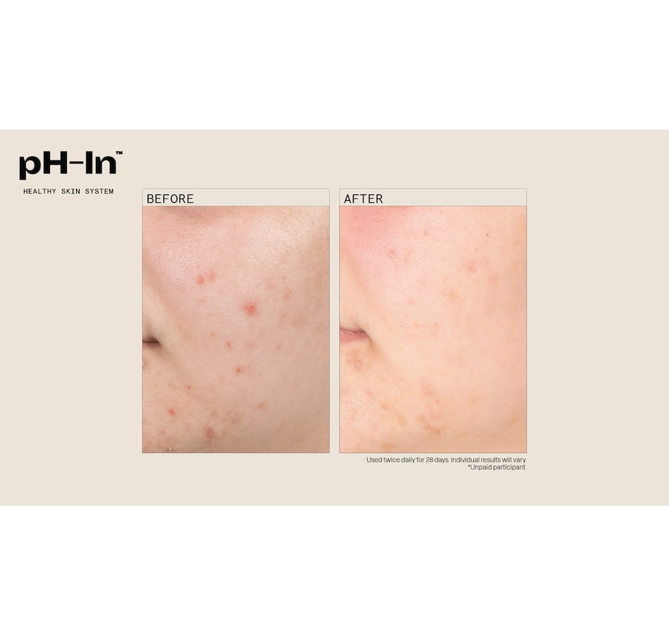 Image 252485_ALTMORE4.jpg, Product 252-485 / Price $84.99, pH-in 3 Step System from pH-In on TSC.ca's Beauty department