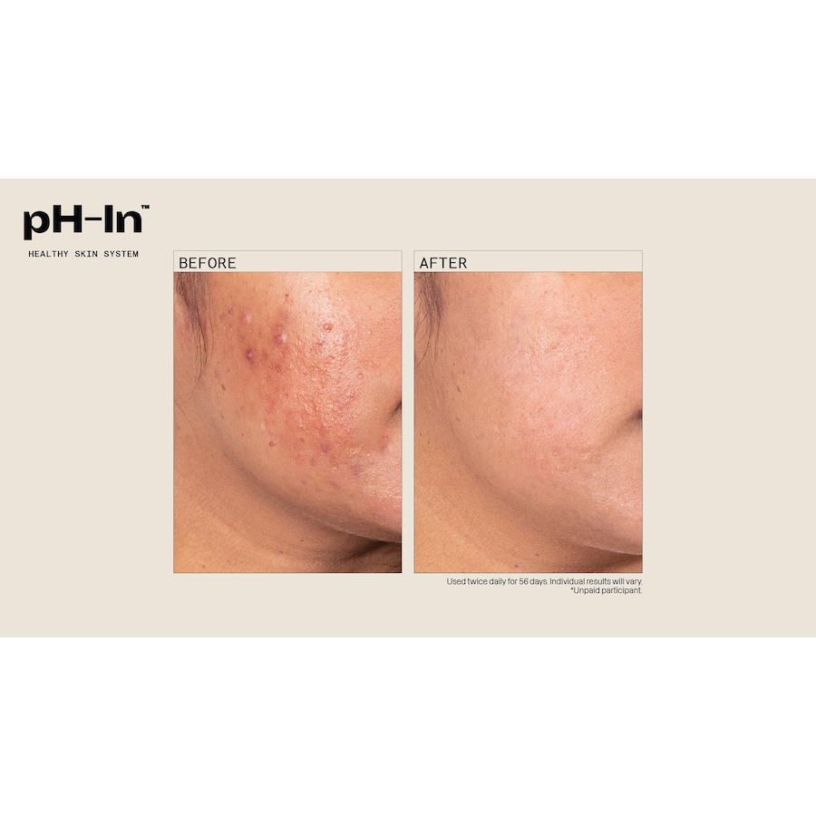 Image 252485_ALTMORE5.jpg, Product 252-485 / Price $84.99, pH-in 3 Step System from pH-In on TSC.ca's Beauty department