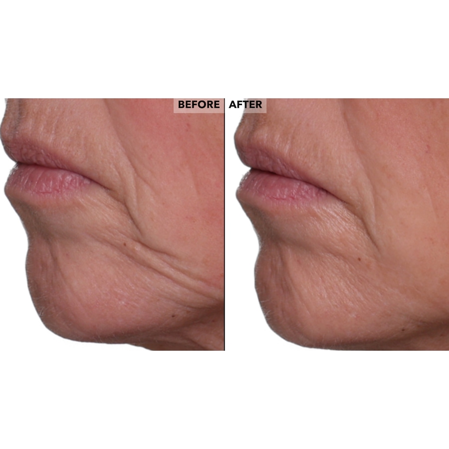 Image 260040_ALTMORE10.jpg, Product 260-040 / Price $42.50, Nakery Skinrepair Double Retinol + Collagen Peptide Treatment from Nakery Beauty on TSC.ca's Beauty department