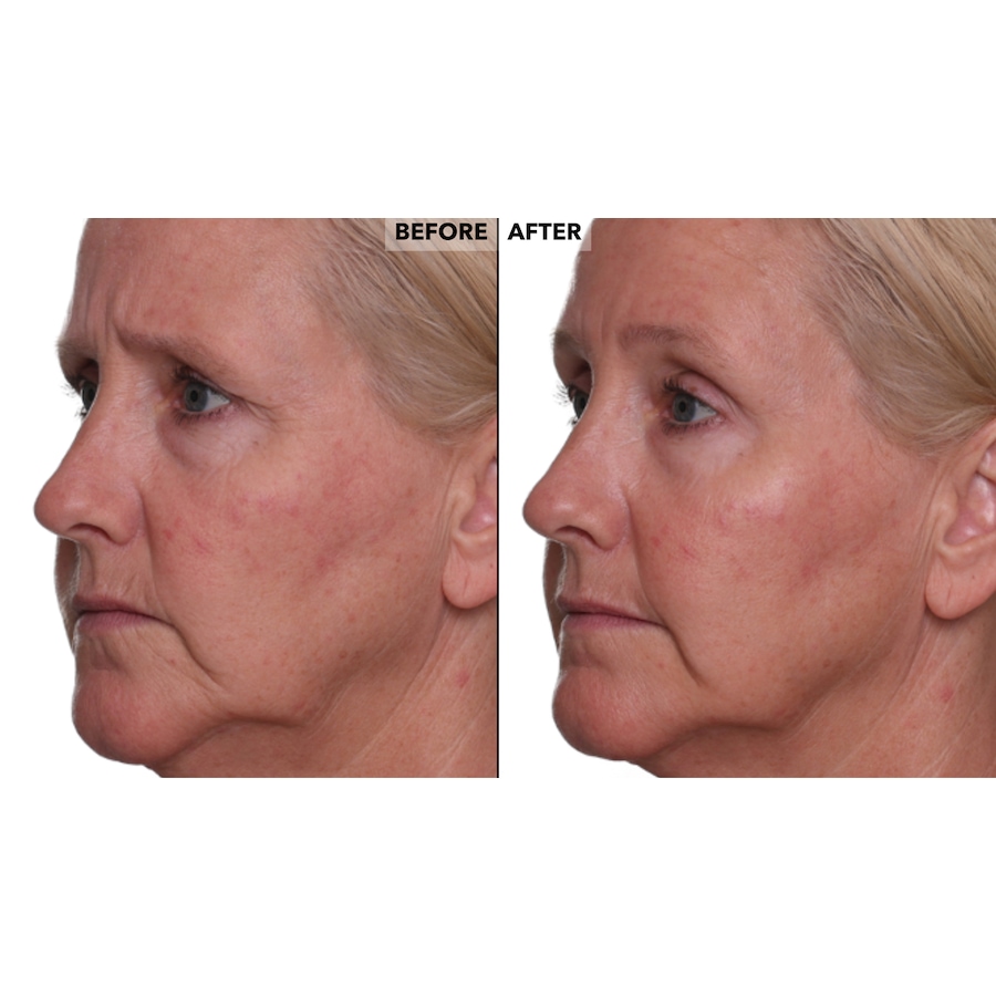 Image 260040_ALTMORE11.jpg, Product 260-040 / Price $42.50, Nakery Skinrepair Double Retinol + Collagen Peptide Treatment from Nakery Beauty on TSC.ca's Beauty department