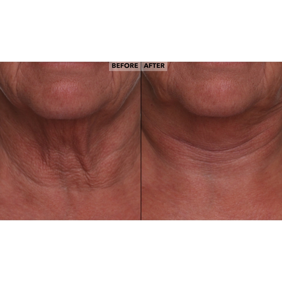 Image 260040_ALTMORE12.jpg, Product 260-040 / Price $42.50, Nakery Skinrepair Double Retinol + Collagen Peptide Treatment from Nakery Beauty on TSC.ca's Beauty department