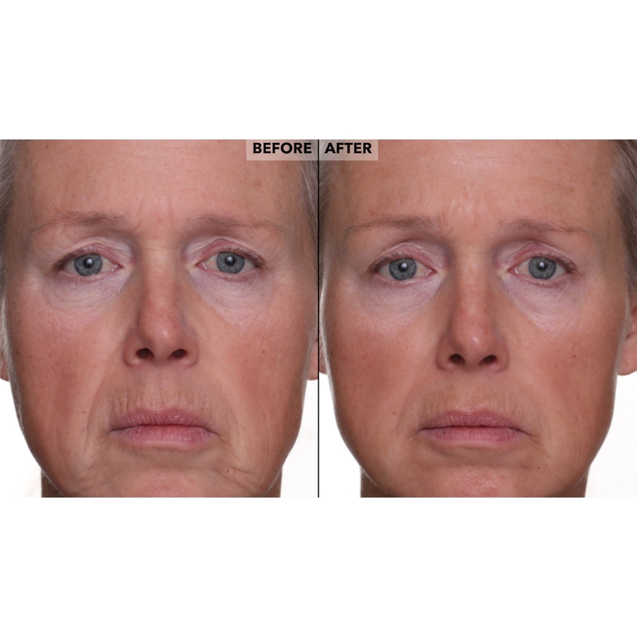 Image 260040_ALTMORE8.jpg, Product 260-040 / Price $42.50, Nakery Skinrepair Double Retinol + Collagen Peptide Treatment from Nakery Beauty on TSC.ca's Beauty department