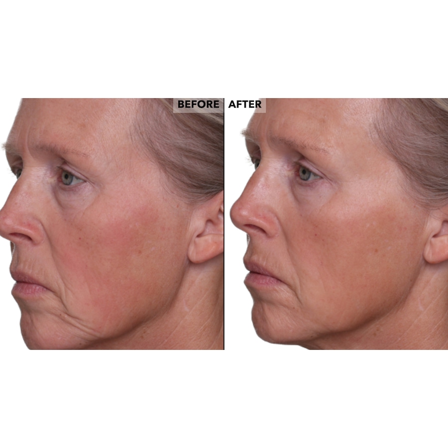 Image 260040_ALTMORE9.jpg, Product 260-040 / Price $42.50, Nakery Skinrepair Double Retinol + Collagen Peptide Treatment from Nakery Beauty on TSC.ca's Beauty department