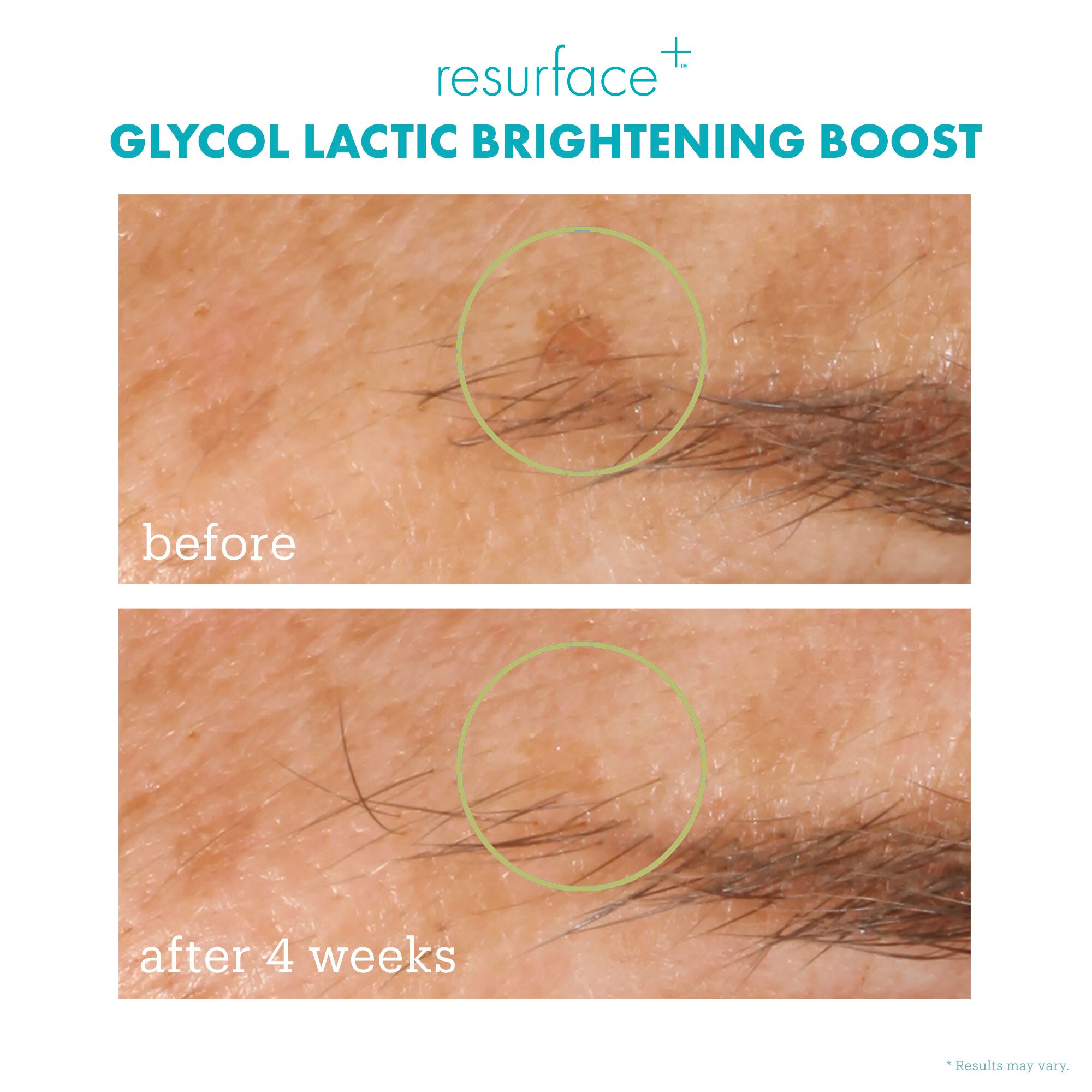 Cheapest Skinfix Glycol Lactic Brightening Boost