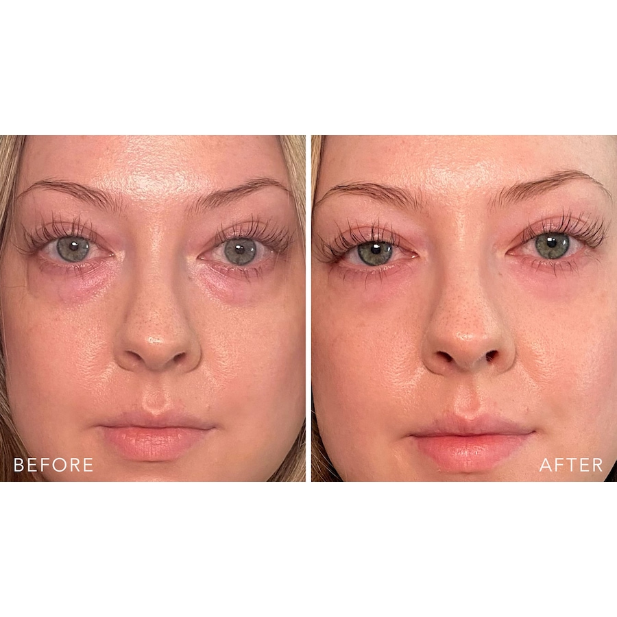 Image 261491_ALTMORE2.jpg, Product 261-491 / Price $74.00, Doll 10 Insta-Tight Peptide Firming Eye Gel Duo from Doll 10 on TSC.ca's Beauty department