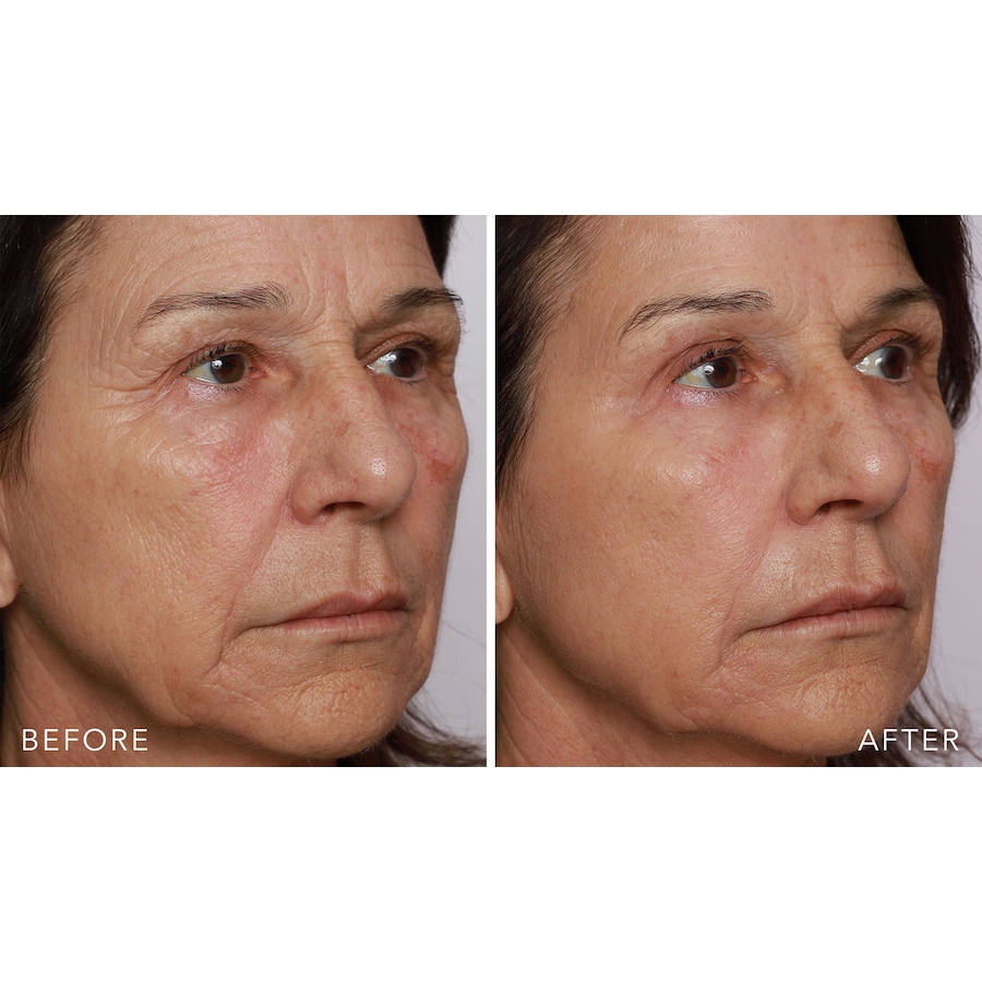 Image 261491_ALTMORE7.jpg, Product 261-491 / Price $74.00, Doll 10 Insta-Tight Peptide Firming Eye Gel Duo from Doll 10 on TSC.ca's Beauty department