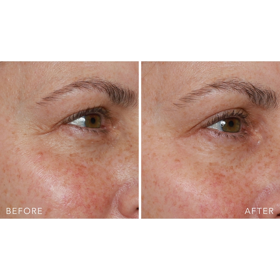 Image 261491_ALTMORE8.jpg, Product 261-491 / Price $74.00, Doll 10 Insta-Tight Peptide Firming Eye Gel Duo from Doll 10 on TSC.ca's Beauty department