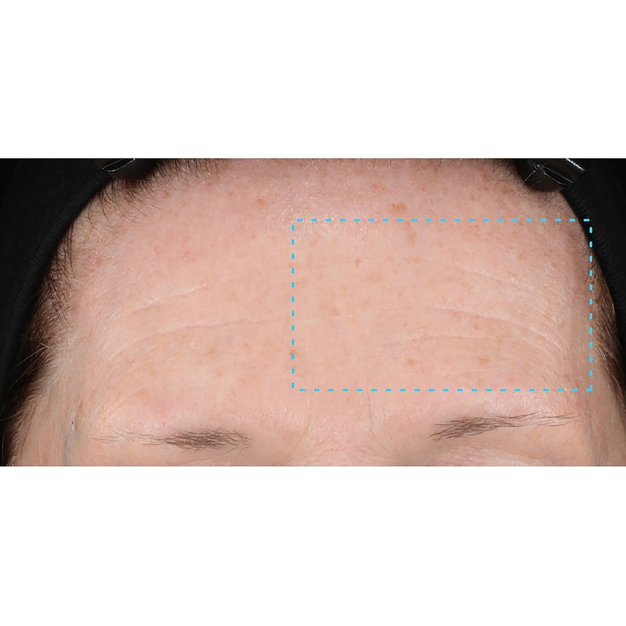 Image 289438_ALTMORE3.jpg, Product 289-438 / Price $186.00, Skinfix Triple Lipid Collagen Activating Serum Duo from Skinfix on TSC.ca's Beauty department