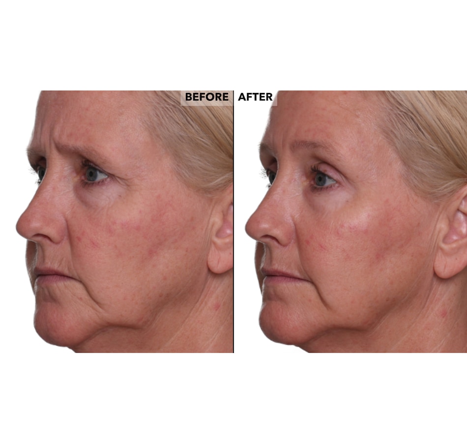 Image 400356_ALTMORE11.jpg, Product 400-356 / Price $49.50, Nakery Retinol + Collagen Cleanse, Repair & Treat Collection from Nakery Beauty on TSC.ca's Beauty department