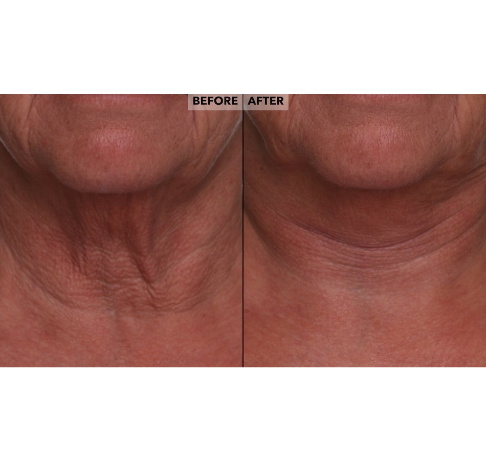 Image 400356_ALTMORE12.jpg, Product 400-356 / Price $49.50, Nakery Retinol + Collagen Cleanse, Repair & Treat Collection from Nakery Beauty on TSC.ca's Beauty department